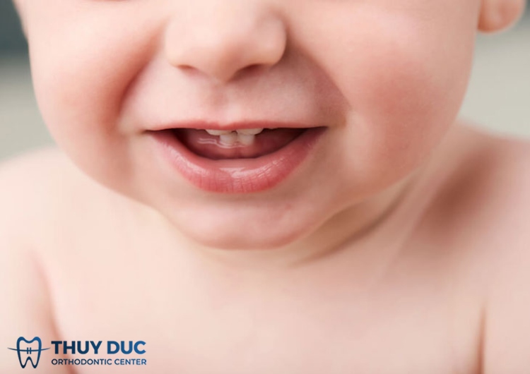 3.2. Bảng thời gian mọc răng sữa từ 6 tháng đến 3 tuổi 1 3.2. Bảng thời gian mọc răng sữa từ 6 tháng đến 3 tuổi 1