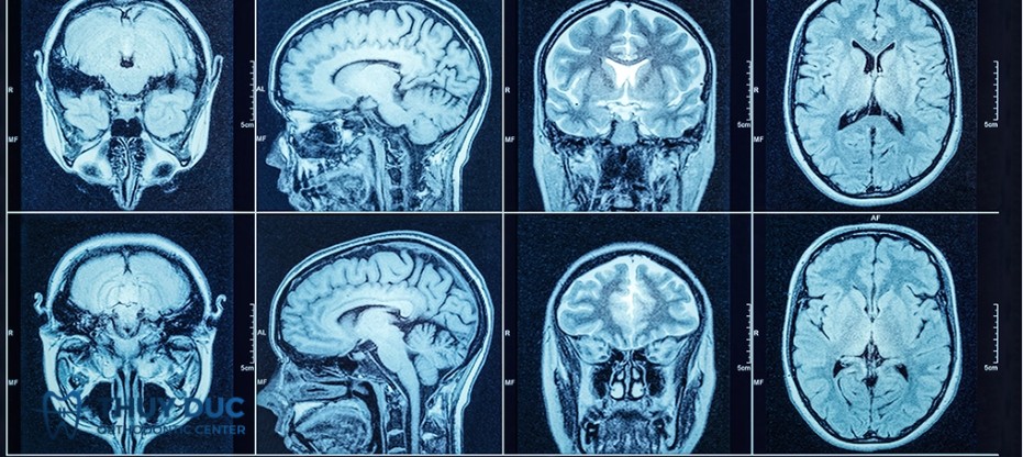Nguyên lý chụp CT 1