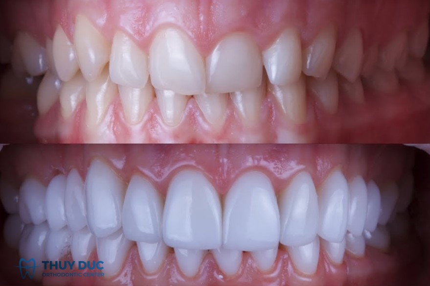 3. Các phương pháp điều trị hiện đại 1 3. Các phương pháp điều trị hiện đại 1