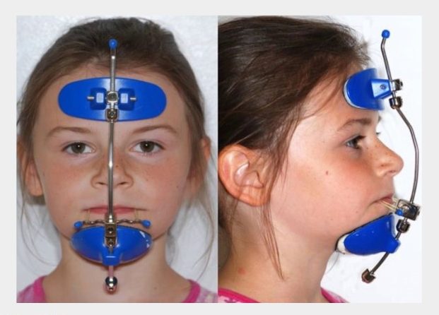 4. Nguyên lý hoạt động của Facemask 1