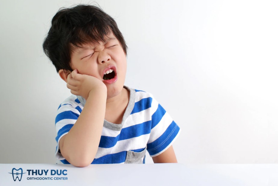 1. Nguyên nhân thường gặp gây vỡ răng ở trẻ 1