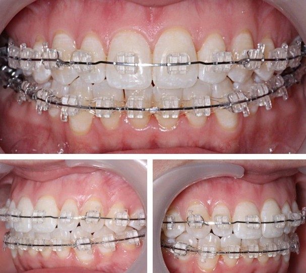 Nhận định từ nha khoa hiện đại 1