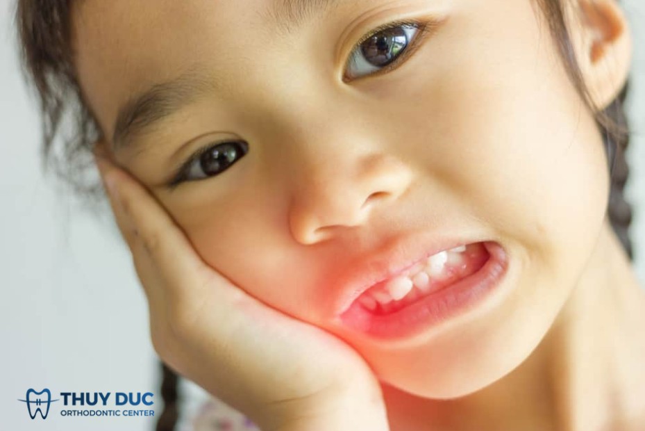 Các triệu chứng rõ ràng 1