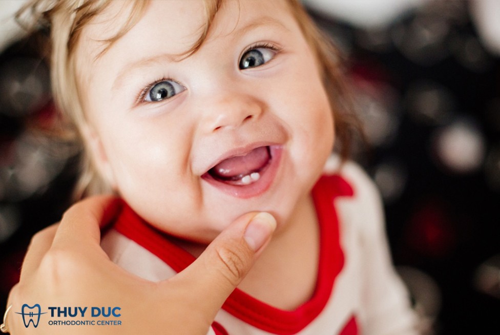 1. Trẻ em có bao nhiêu răng sữa? 1 1. Trẻ em có bao nhiêu răng sữa? 1