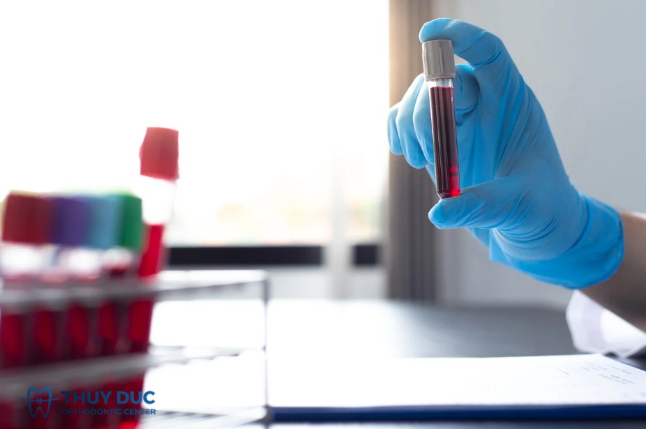 4. Các xét nghiệm cần thiết nếu nghi ngờ mọc răng chậm do bệnh lý 1 4. Các xét nghiệm cần thiết nếu nghi ngờ mọc răng chậm do bệnh lý 1